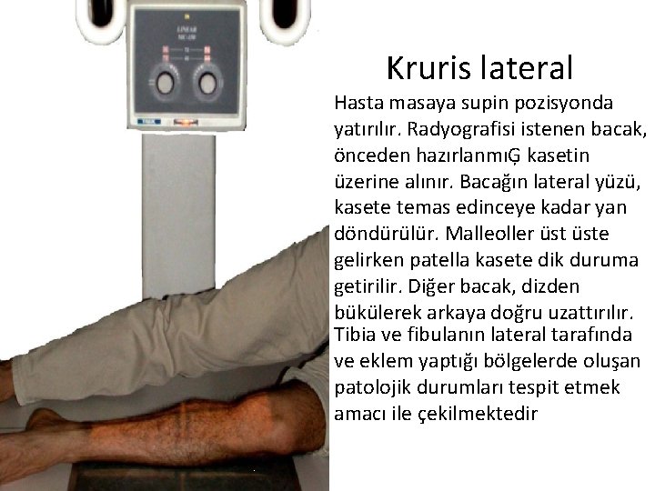 Kruris lateral Hasta masaya supin pozisyonda yatırılır. Radyografisi istenen bacak, önceden hazırlanmıĢ kasetin üzerine