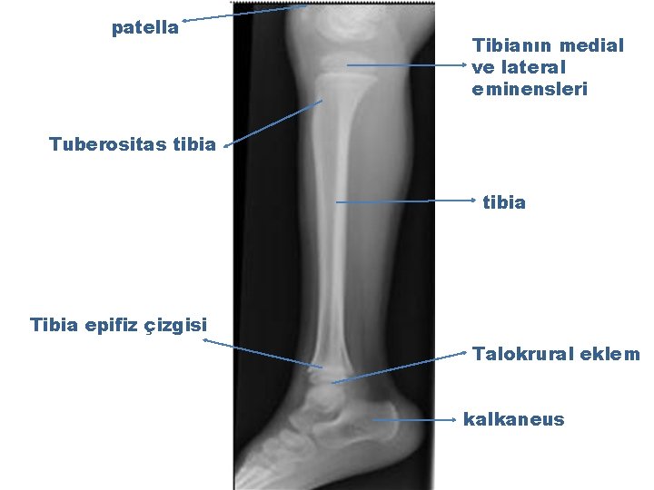 patella ta Tibianın medial ve lateral eminensleri Tuberositas tibia Tibia epifiz çizgisi Talokrural eklem