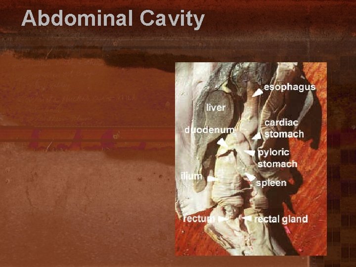 Abdominal Cavity 