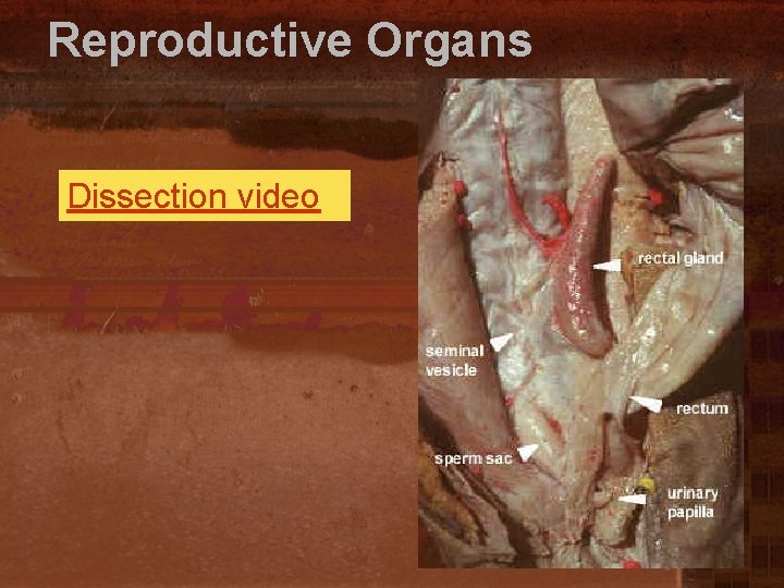 Reproductive Organs Dissection video 