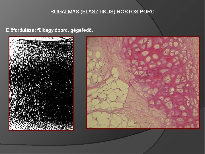 RUGALMAS (ELASZTIKUS) ROSTOS PORC Előfordulása: fülkagylóporc, gégefedő. 