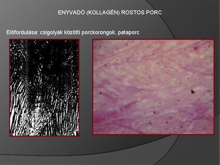 ENYVADÓ (KOLLAGÉN) ROSTOS PORC Előfordulása: csigolyák közötti porckorongok, pataporc 