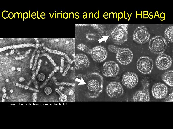 Complete virions and empty HBs. Ag www. uct. ac. za/depts/mmi/stannard/hepb. html. 