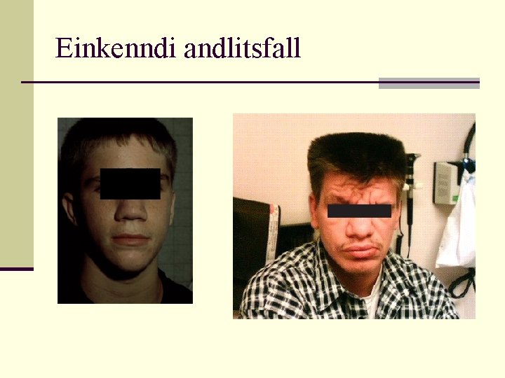 Einkenndi andlitsfall 