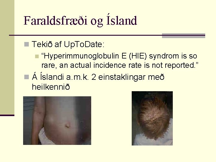 Faraldsfræði og Ísland n Tekið af Up. To. Date: n “Hyperimmunoglobulin E (HIE) syndrom