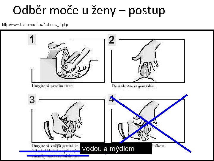 Odběr moče u ženy – postup http: //www. lab-turnov. ic. cz/schema_1. php vodou a