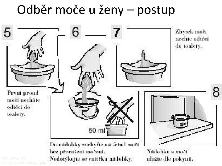 Odběr moče u ženy – postup http: //www. labturnov. ic. cz/schema_1. php 