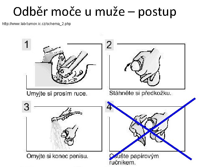 Odběr moče u muže – postup http: //www. lab-turnov. ic. cz/schema_2. php 