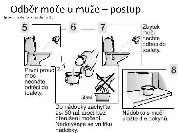 Odběr moče u muže – postup http: //www. lab-turnov. ic. cz/schema_2. php 