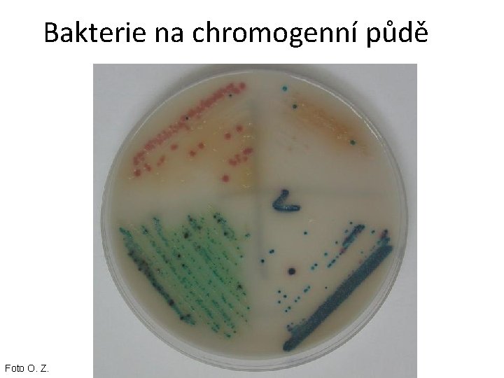 Bakterie na chromogenní půdě Foto O. Z. 