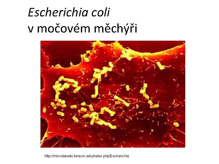 Escherichia coli v močovém měchýři http: //microbewiki. kenyon. edu/index. php/Escherichia 