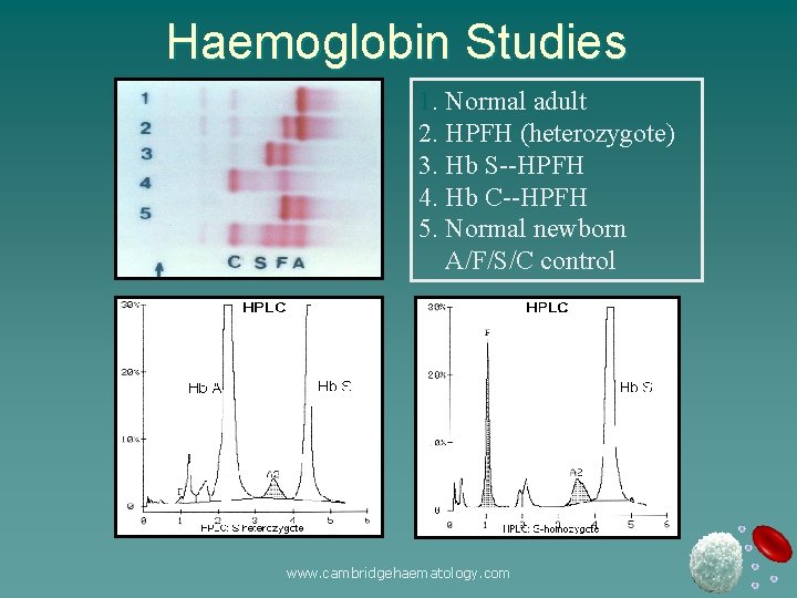 Haemoglobin Studies 1. Normal adult 2. HPFH (heterozygote) 3. Hb S--HPFH 4. Hb C--HPFH