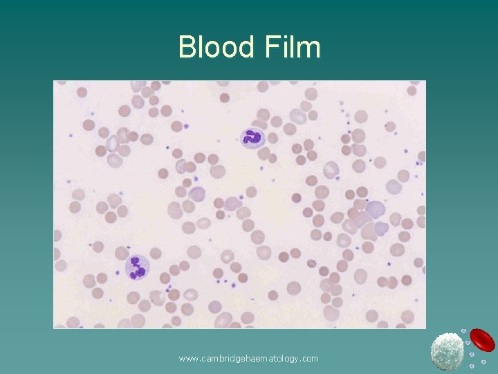 Blood Film www. cambridgehaematology. com 