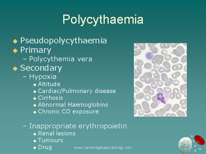 Polycythaemia Pseudopolycythaemia u Primary u – Polycythemia vera u Secondary – Hypoxia u Altitude