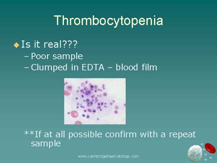 Thrombocytopenia u Is it real? ? ? – Poor sample – Clumped in EDTA