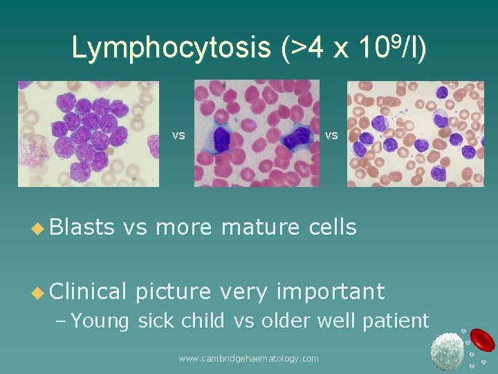 Lymphocytosis (>4 x 109/l) vs u Blasts vs vs more mature cells u Clinical