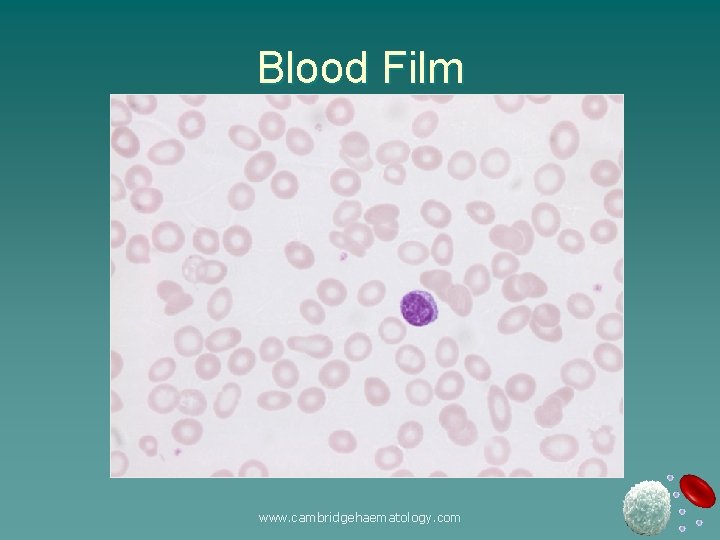 Blood Film www. cambridgehaematology. com 