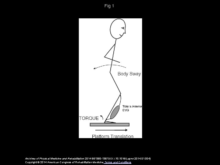 Fig 1 Archives of Physical Medicine and Rehabilitation 2014 951390 -1397 DOI: (10. 1016/j.