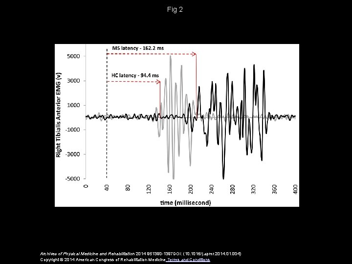 Fig 2 Archives of Physical Medicine and Rehabilitation 2014 951390 -1397 DOI: (10. 1016/j.