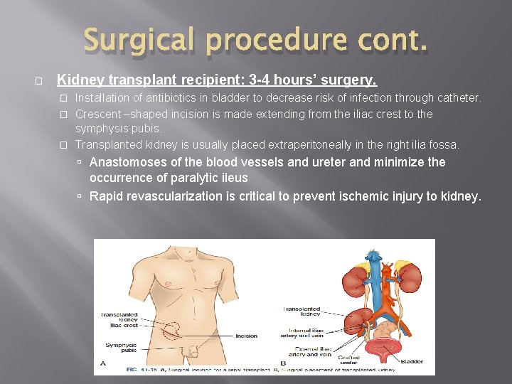 Surgical procedure cont. � Kidney transplant recipient: 3 -4 hours’ surgery. Installation of antibiotics