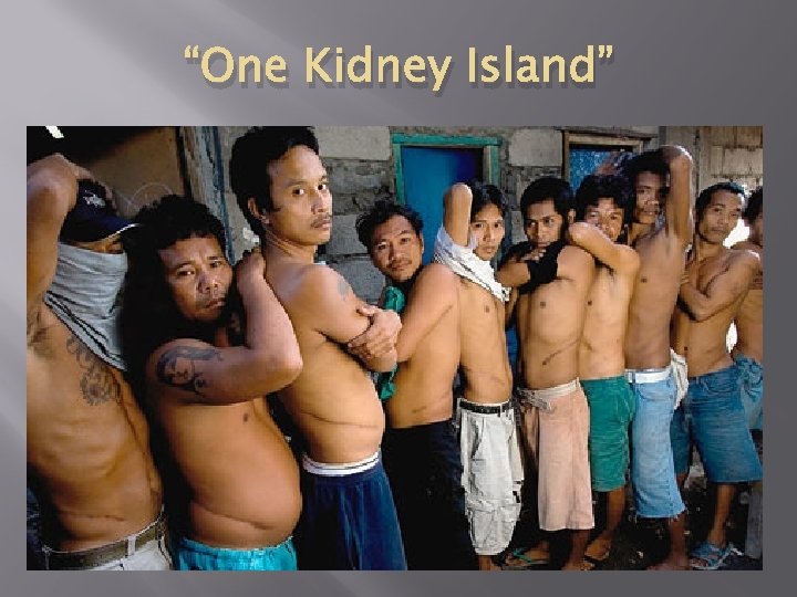 “One Kidney Island” 