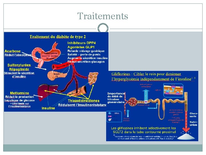 Traitements 