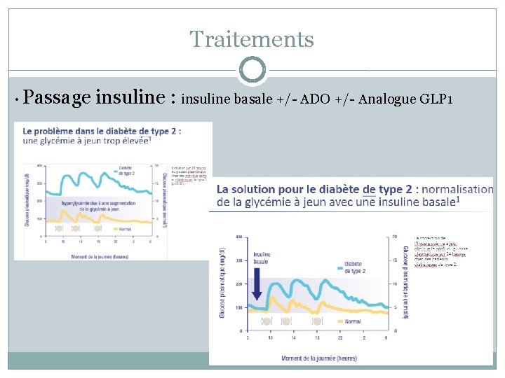 Traitements • Passage insuline : insuline basale +/- ADO +/- Analogue GLP 1 