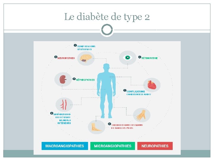 Le diabète de type 2 