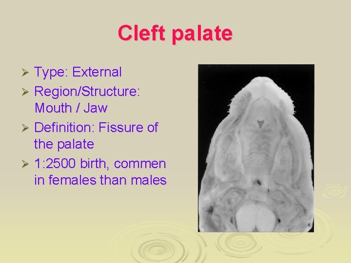 Cleft palate Type: External Ø Region/Structure: Mouth / Jaw Ø Definition: Fissure of the