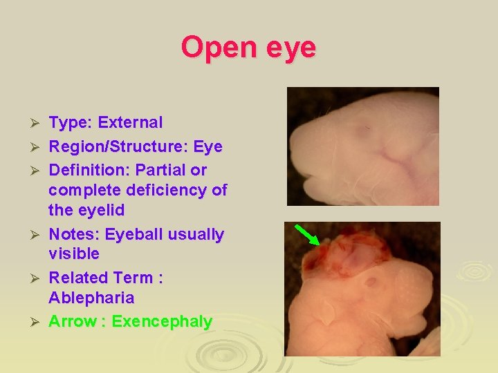 Open eye Ø Ø Ø Type: External Region/Structure: Eye Definition: Partial or complete deficiency