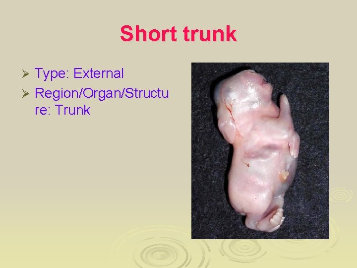 Short trunk Type: External Ø Region/Organ/Structu re: Trunk Ø 