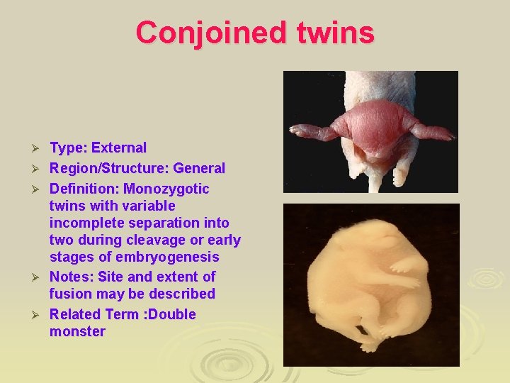 Conjoined twins Ø Ø Ø Type: External Region/Structure: General Definition: Monozygotic twins with variable