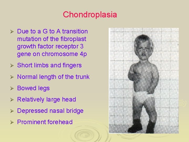 Chondroplasia Ø Due to a G to A transition mutation of the fibroplast growth