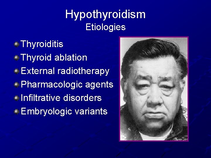 Hypothyroidism Etiologies Thyroiditis Thyroid ablation External radiotherapy Pharmacologic agents Infiltrative disorders Embryologic variants 