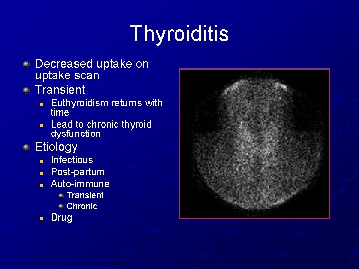 Thyroiditis Decreased uptake on uptake scan Transient n n Euthyroidism returns with time Lead