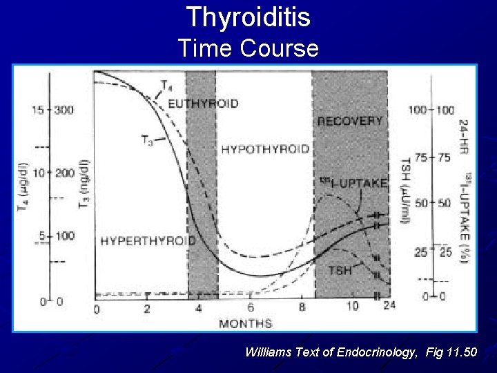 Thyroiditis Time Course Williams Text of Endocrinology, Fig 11. 50 