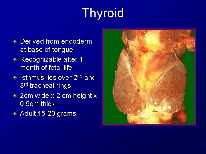 Thyroid Derived from endoderm at base of tongue Recognizable after 1 month of fetal