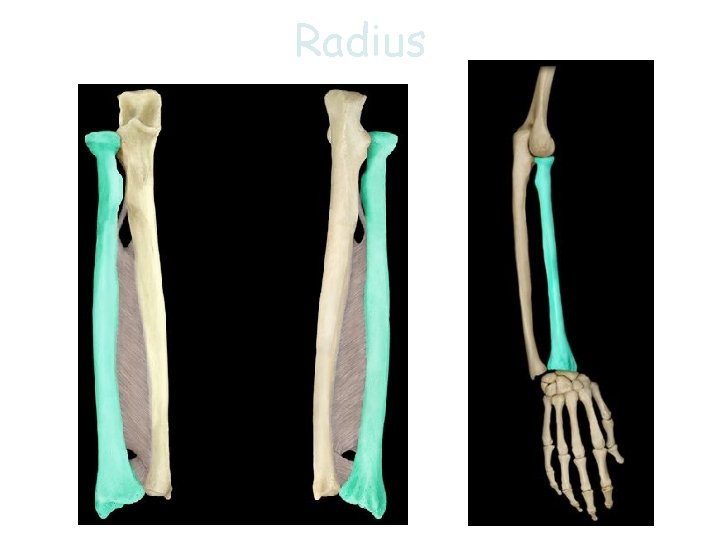 Radius 20 