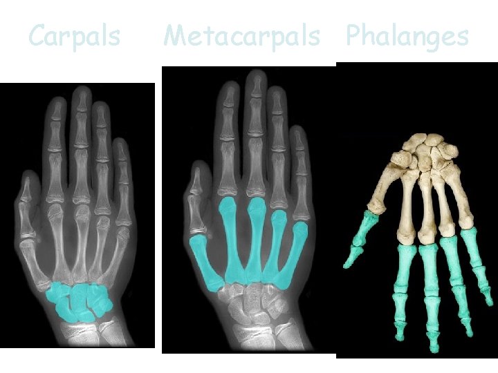 Carpals Metacarpals Phalanges 24 