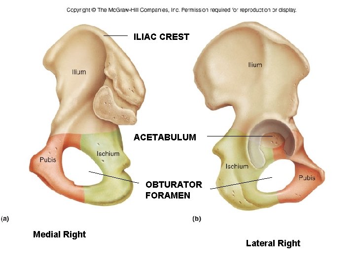 ILIAC CREST ACETABULUM OBTURATOR FORAMEN Medial Right Lateral Right 