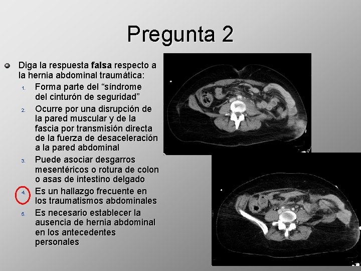 Pregunta 2 Diga la respuesta falsa respecto a la hernia abdominal traumática: 1. Forma