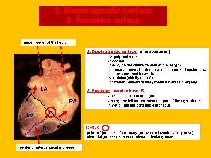 2. Diaphragmatic surface 3. Posterior suface -upper border of the heart 2. Diaphragmatic surface