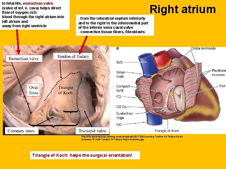 In fetal life, eustachian valve (valve of inf. v. cava) helps direct flow of