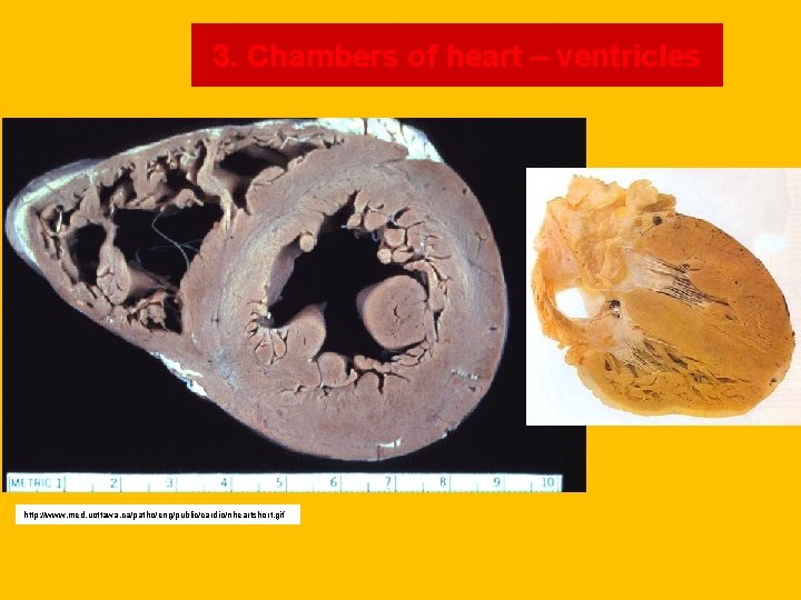 3. Chambers of heart – ventricles http: //www. med. uottawa. ca/patho/eng/public/cardio/nheartshort. gif 