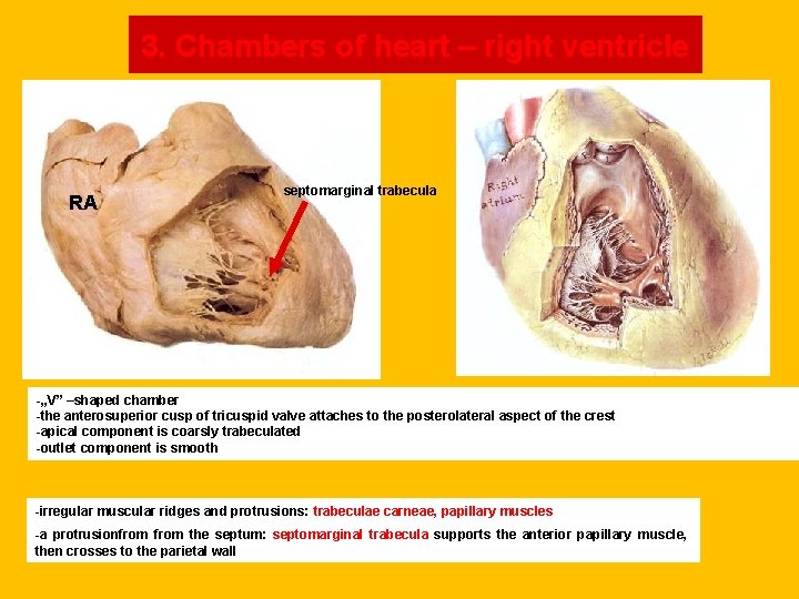 3. Chambers of heart – right ventricle RA septomarginal trabecula -„V” –shaped chamber -the