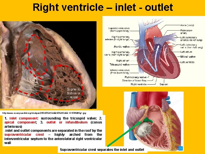 Right ventricle – inlet - outlet http: //www. revespcardiol. org/imatges/255 v 63 n 09/255