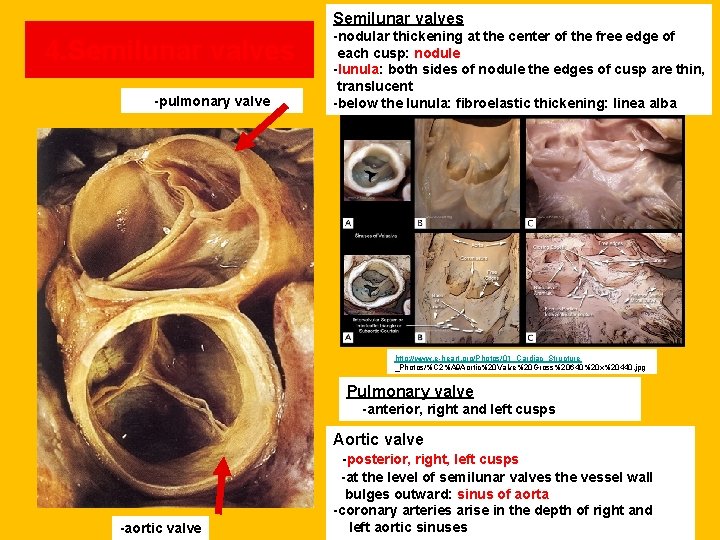 Semilunar valves 4. Semilunar valves -pulmonary valve -nodular thickening at the center of the