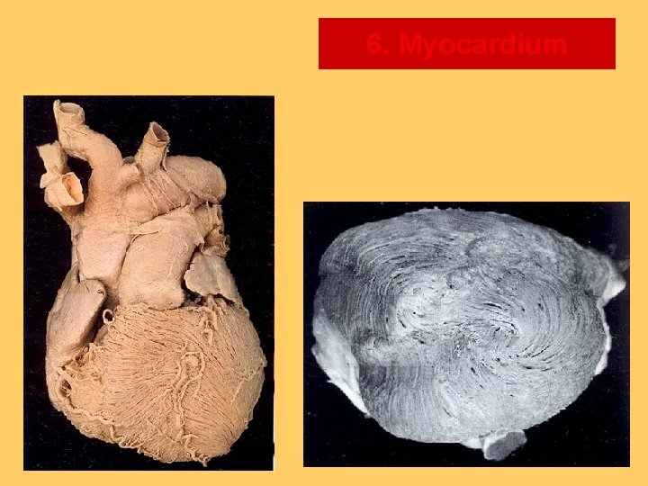 6. Myocardium 