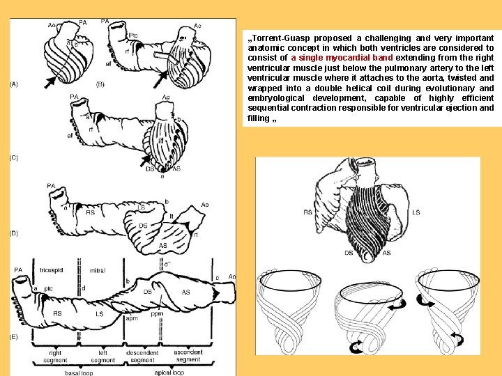 „Torrent-Guasp proposed a challenging and very important anatomic concept in which both ventricles are