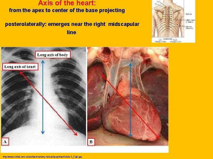 Axis of the heart: from the apex to center of the base projecting posterolaterally: